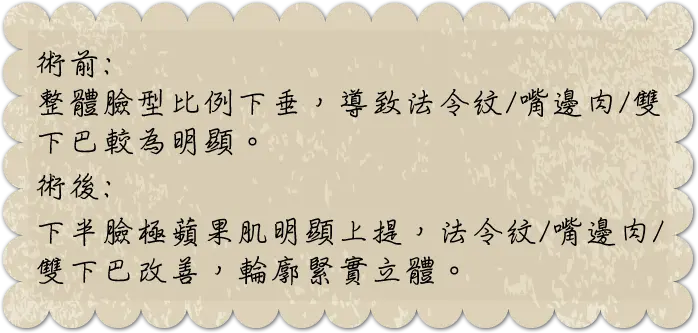 Doublo倍提音波拉提|少女針價格,奇蹟針,台北醫美推薦,雷射除毛